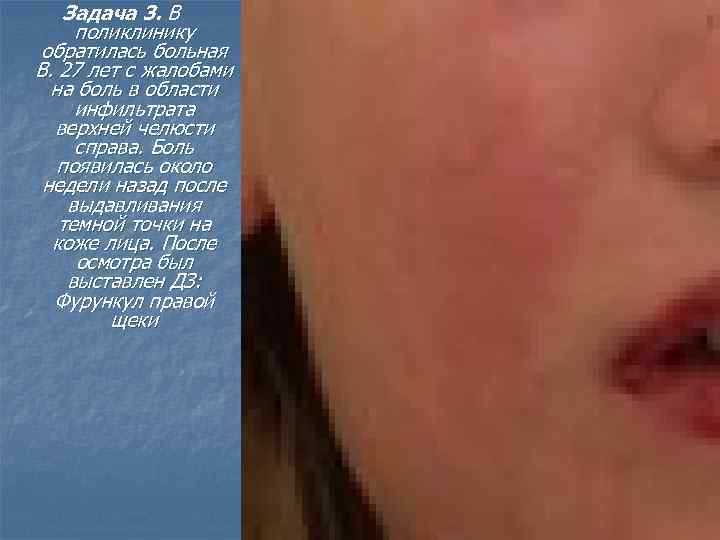 Задача 3. В поликлинику обратилась больная В. 27 лет с жалобами на боль в