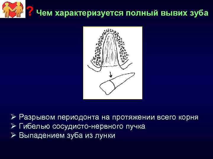 ? Чем характеризуется полный вывих зуба Ø Разрывом периодонта на протяжении всего корня Ø