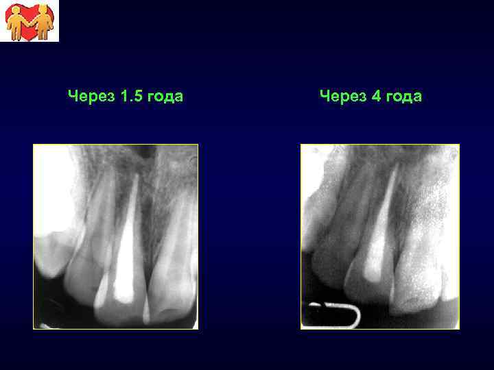 Через 1. 5 года Через 4 года 