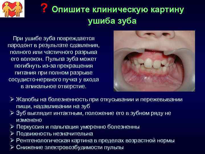 ? Опишите клиническую картину ушиба зуба При ушибе зуба повреждается пародонт в результате сдавления,