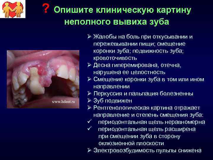 ? Опишите клиническую картину неполного вывиха зуба Ø Жалобы на боль при откусывании и