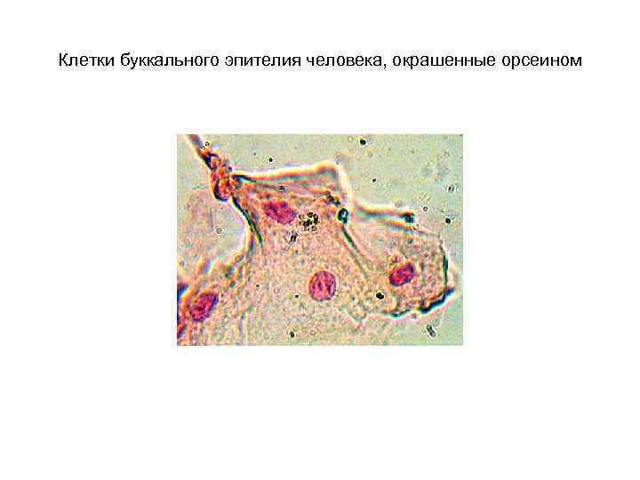 Клетки буккального эпителия человека, окрашенные орсеином 