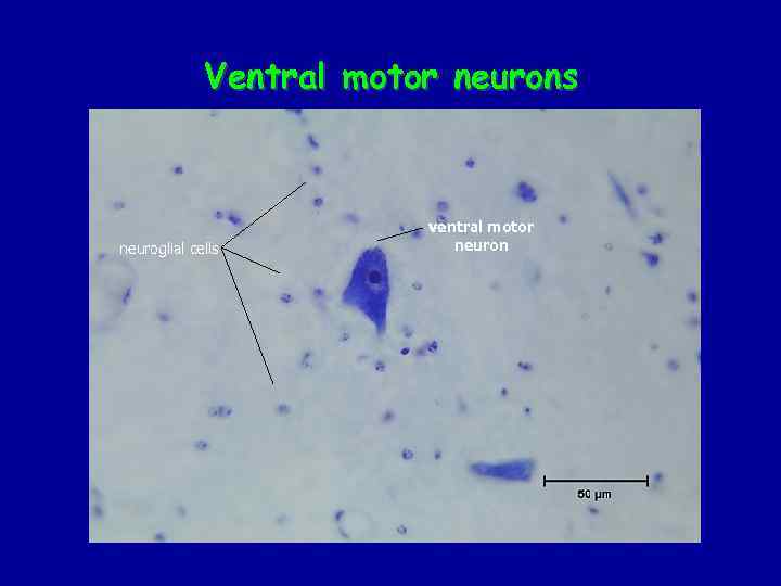 Ventral motor neurons neuroglial cells ventral motor neuron 
