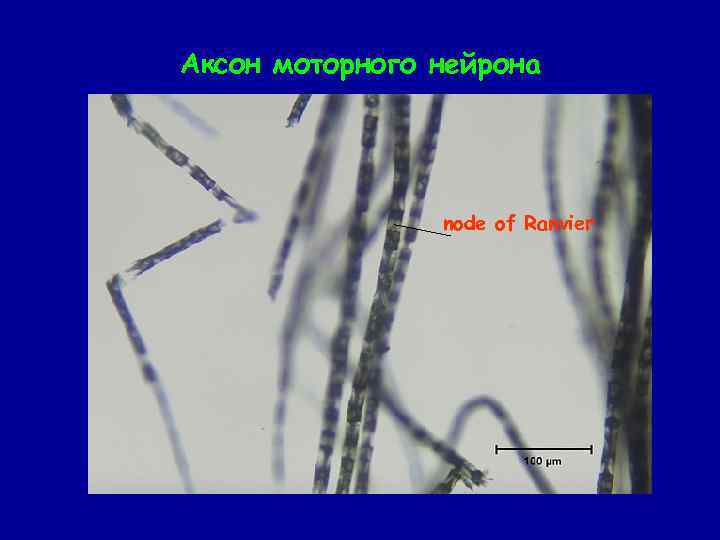 Аксон моторного нейрона node of Ranvier 