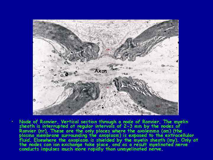 Axon • Node of Ranvier. Vertical section through a node of Ranvier. The myelin