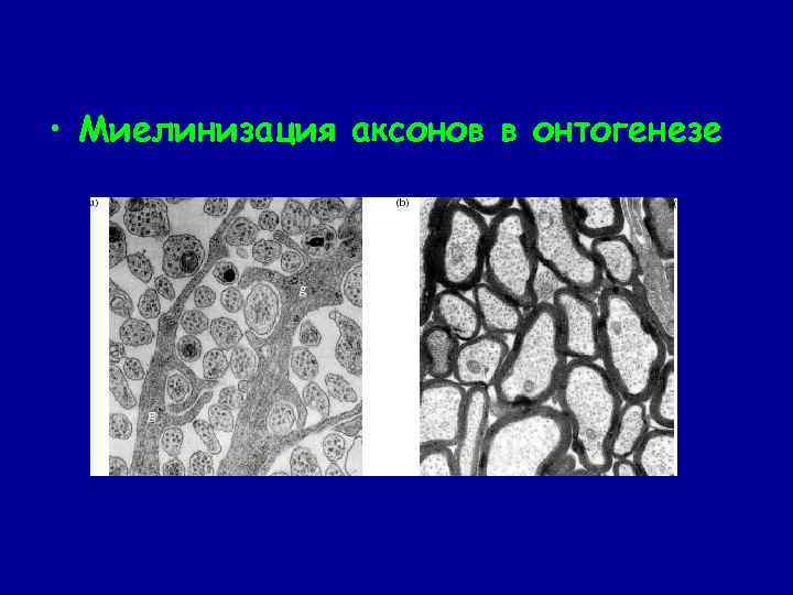  • Миелинизация аксонов в онтогенезе 