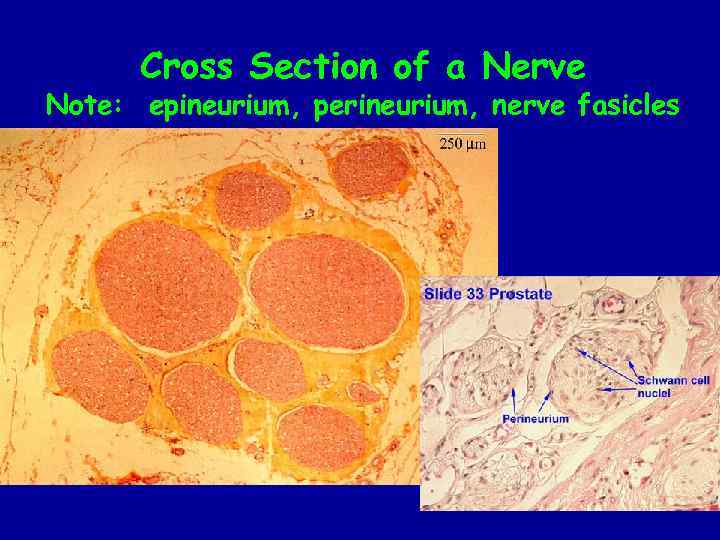 Cross Section of a Nerve Note: epineurium, perineurium, nerve fasicles 