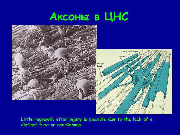 Аксоны в ЦНС Little regrowth after injury is possible due to the lack of