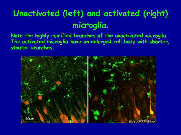 Unactivated (left) and activated (right) microglia. Note the highly ramified branches of the unactivated