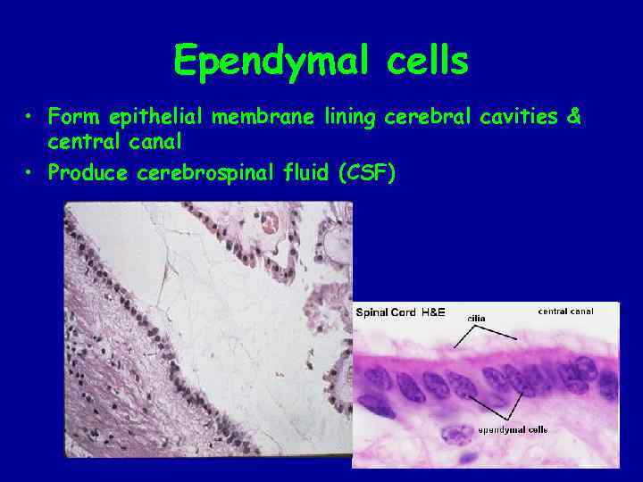 Ependymal cells • Form epithelial membrane lining cerebral cavities & central canal • Produce