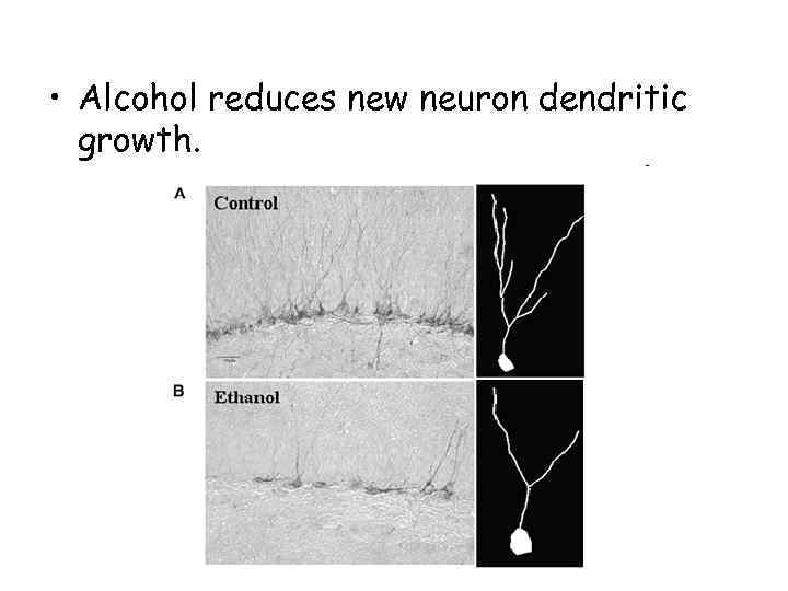  • Alcohol reduces new neuron dendritic growth. 