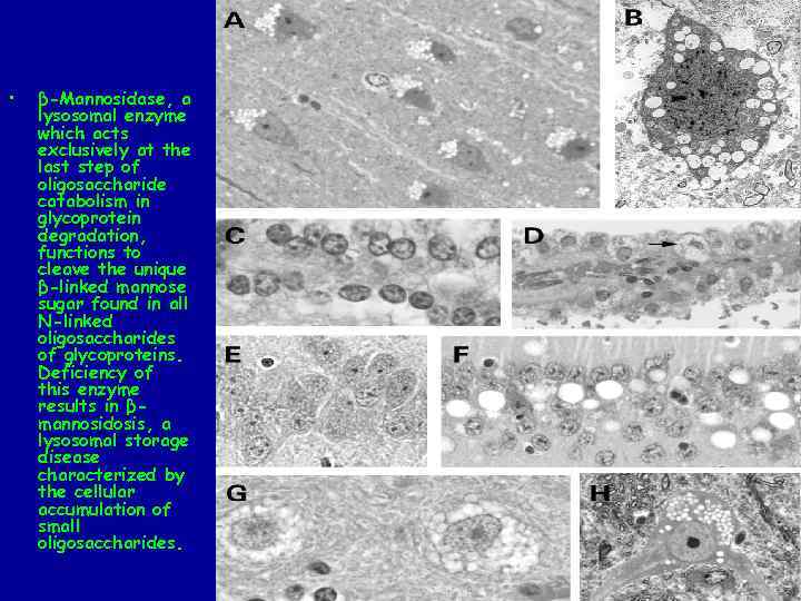  • β-Mannosidase, a lysosomal enzyme which acts exclusively at the last step of
