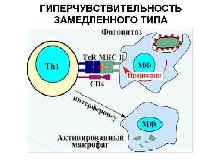 ГИПЕРЧУВСТВИТЕЛЬНОСТЬ ЗАМЕДЛЕННОГО ТИПА 