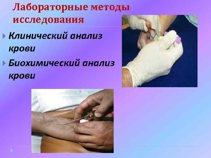 Лабораторные методы исследования Клинический анализ крови Биохимический анализ крови 