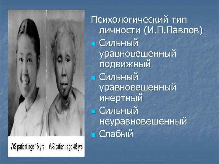 Психологический тип личности (И. П. Павлов) n Сильный уравновешенный подвижный n Сильный уравновешенный инертный