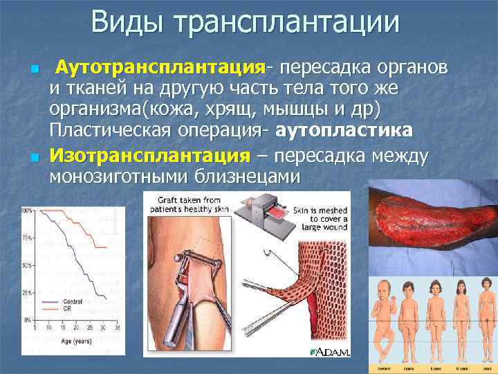 Виды трансплантации n n Аутотрансплантация- пересадка органов и тканей на другую часть тела того