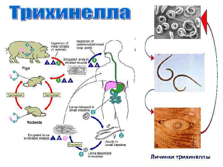  Личинки трихинеллы 