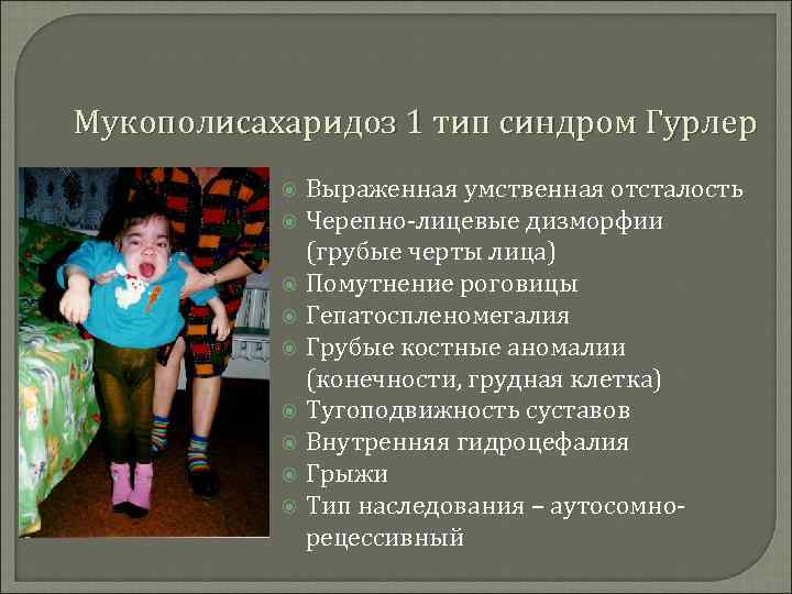 Мукополисахаридоз 1 тип синдром Гурлер Выраженная умственная отсталость Черепно-лицевые дизморфии (грубые черты лица) Помутнение