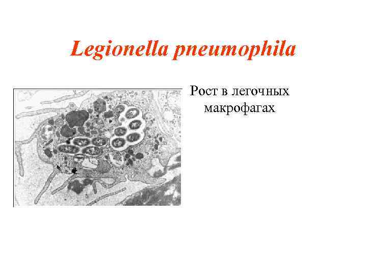 Legionella pneumophila Рост в легочных макрофагах 