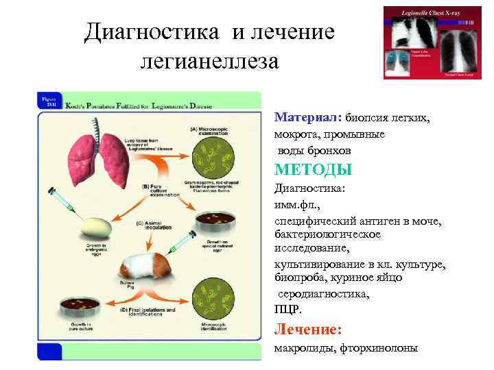 Диагностика и лечение легианеллеза • Материал: биопсия легких, • • мокрота, промывные воды бронхов
