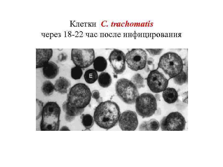 Клетки C. trachomatis через 18 -22 час после инфицирования 