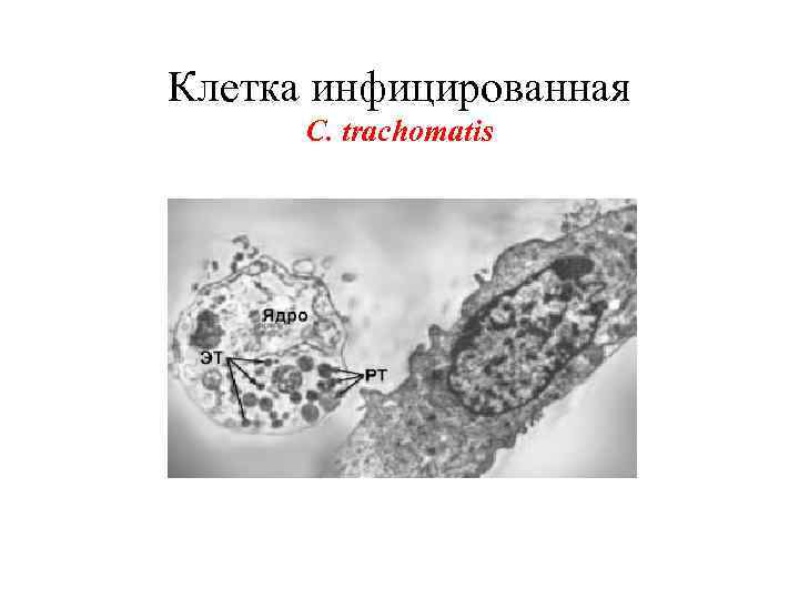 Клетка инфицированная C. trachomatis 