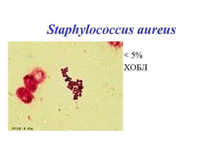 Staphylococcus aureus • < 5% • ХОБЛ 