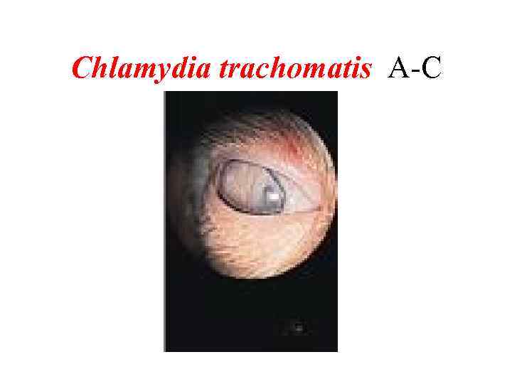 Сhlamydia trаchomatis A-C 