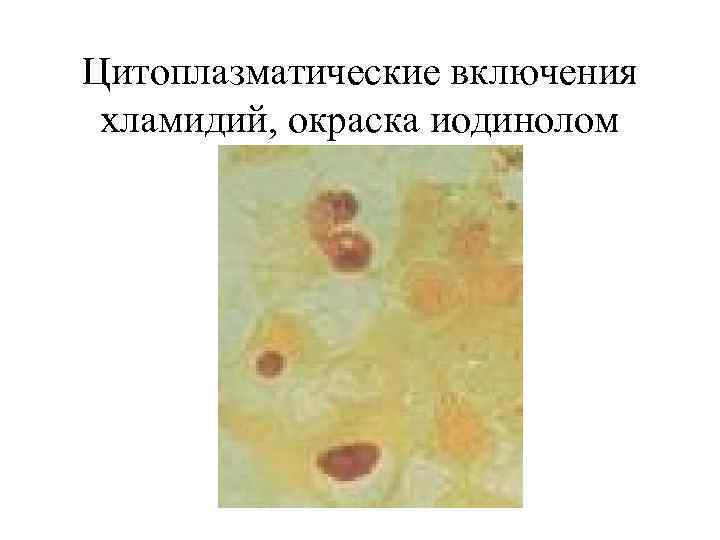 Цитоплазматические включения хламидий, окраска иодинолом 