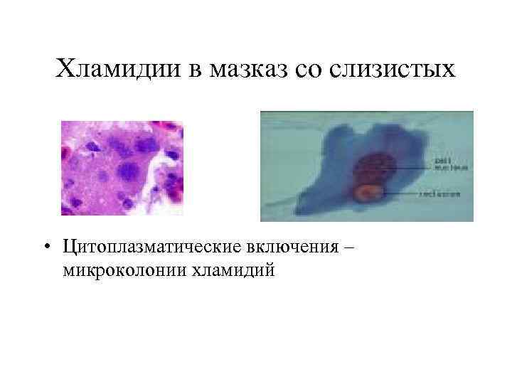 Хламидии в мазказ со слизистых • Цитоплазматические включения – микроколонии хламидий 