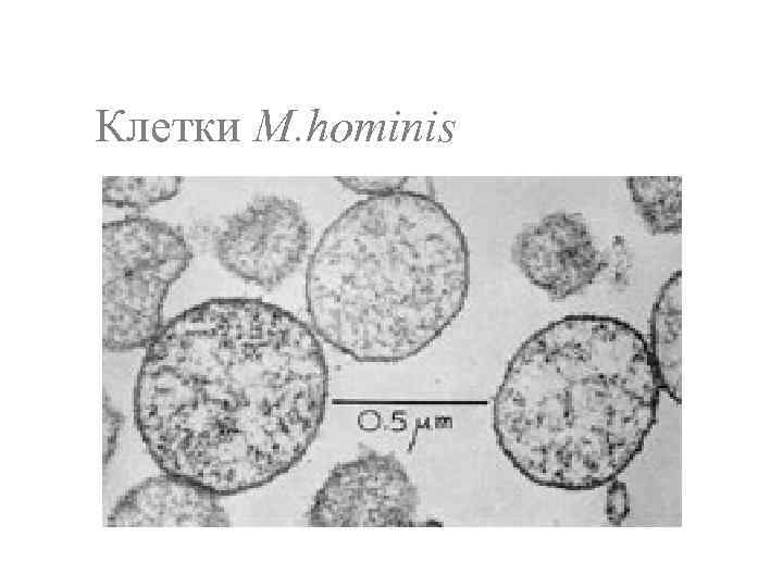 Клетки M. hominis 