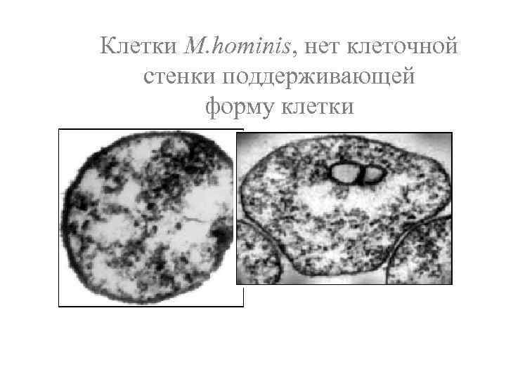 Клетки M. hominis, нет клеточной стенки поддерживающей форму клетки 