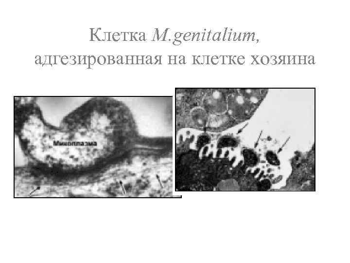 Клетка M. genitalium, адгезированная на клетке хозяина 
