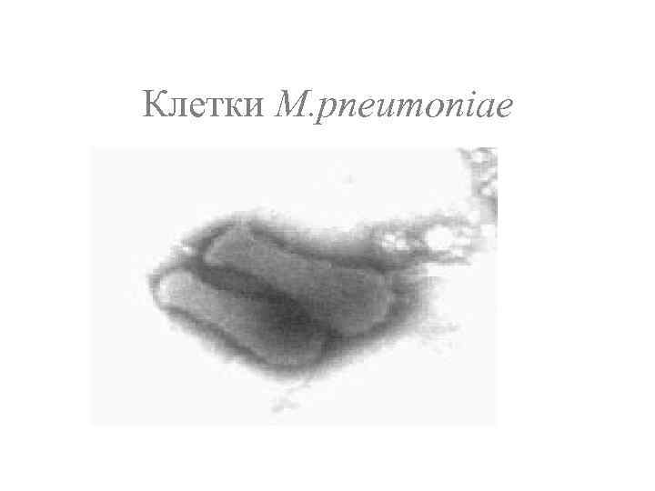 Клетки M. pneumoniae 