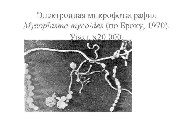 Электронная микрофотография Mycoplasma mycoides (по Броку, 1970). Увел. х20 000. 