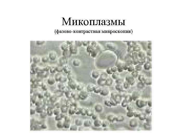 Микоплазмы (фазово-контрастная микроскопия) 