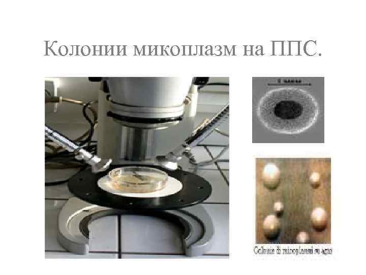 Колонии микоплазм на ППС. 