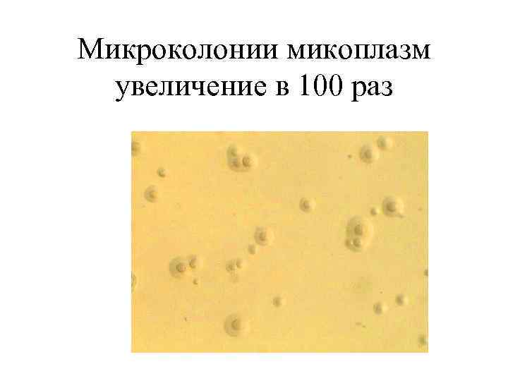 Микроколонии микоплазм увеличение в 100 раз 