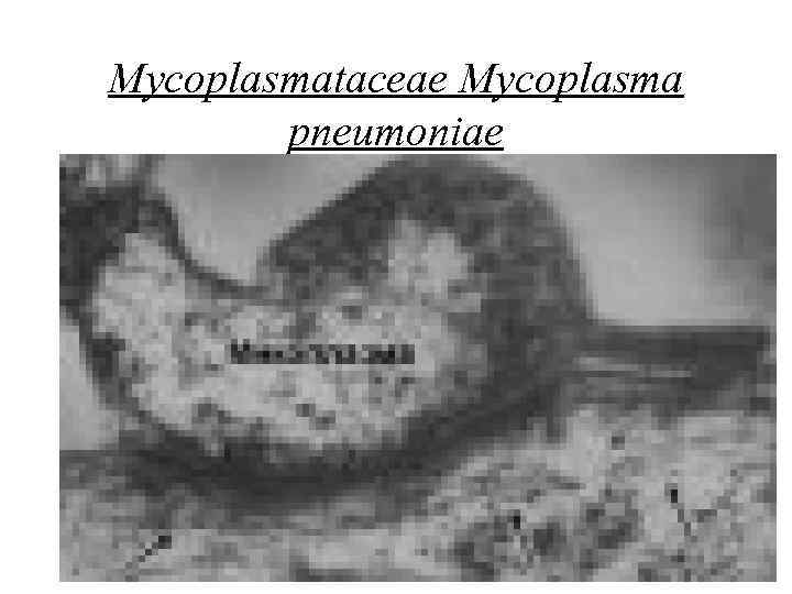 Mycoplasmataceae Mycoplasma pneumoniae 