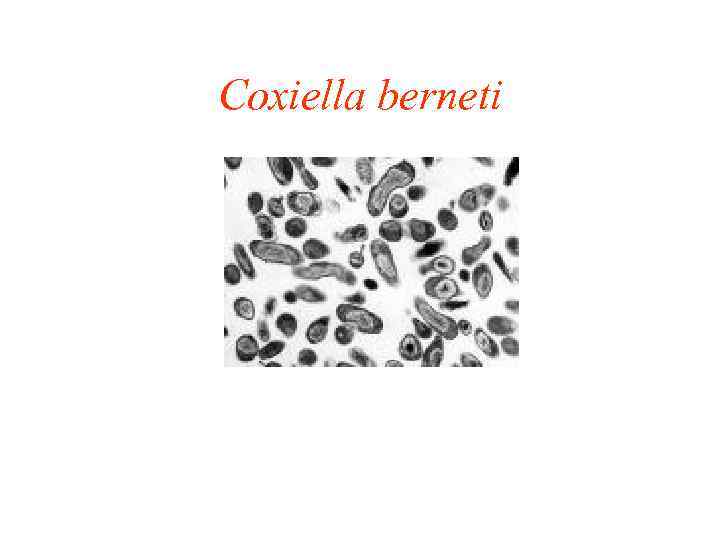 Coxiella berneti 