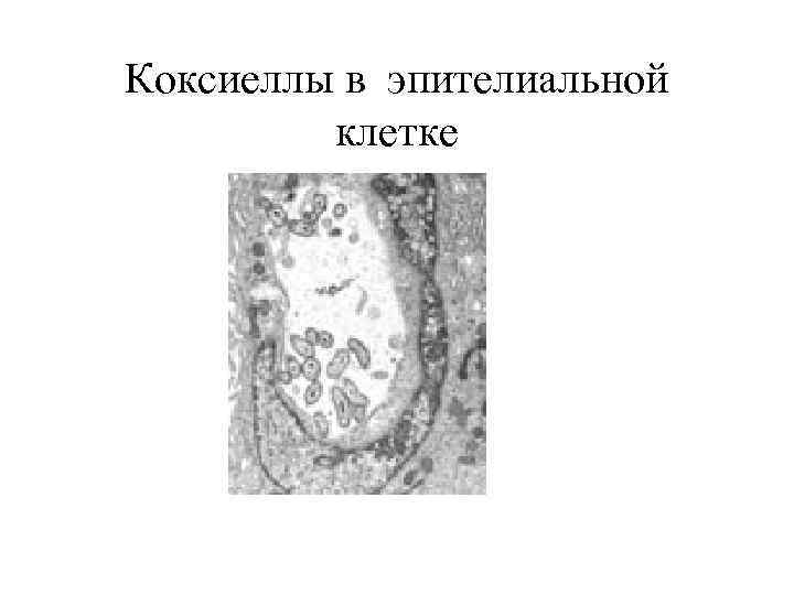 Коксиеллы в эпителиальной клетке 