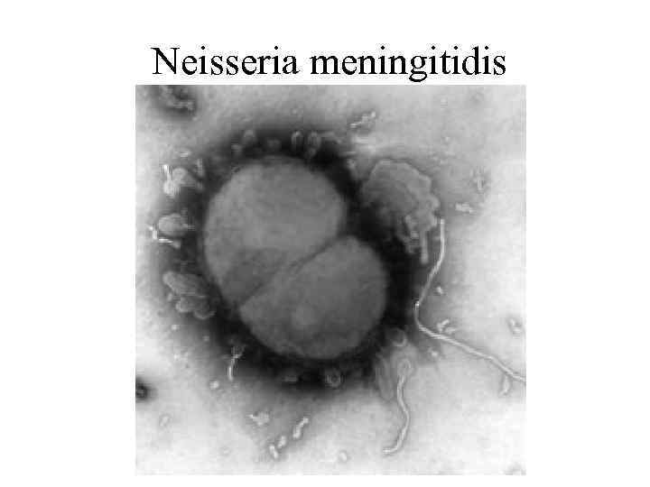 Neisseria meningitidis 