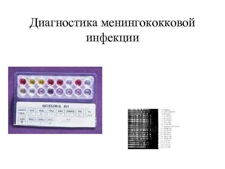 Диагностика менингококковой инфекции 