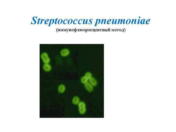Streptococcus pneumoniae (иммунофлюоресцентный метод) 