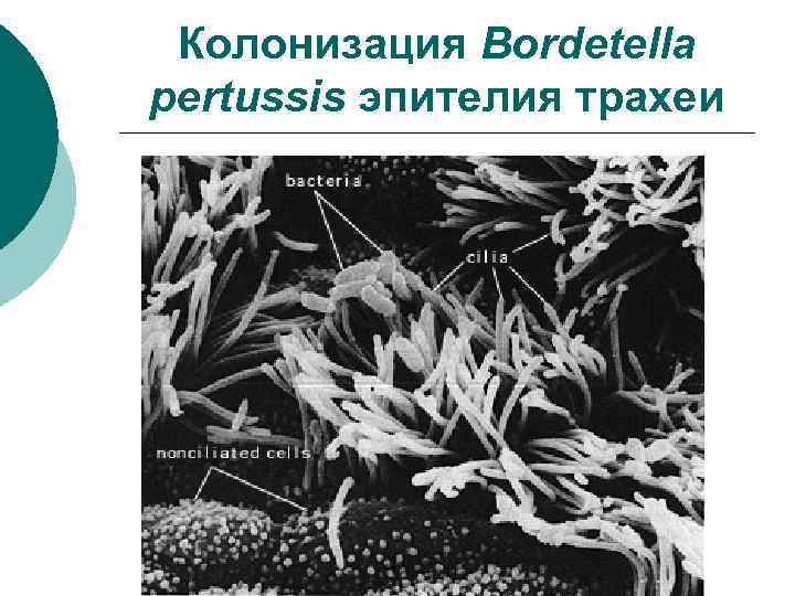 Колонизация Bordetella pertussis эпителия трахеи 