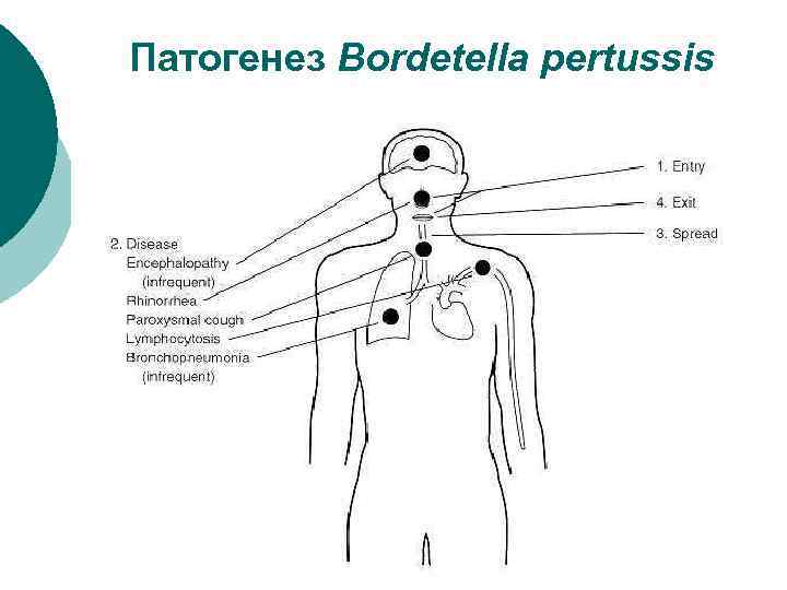 Патогенез Bordetella pertussis 