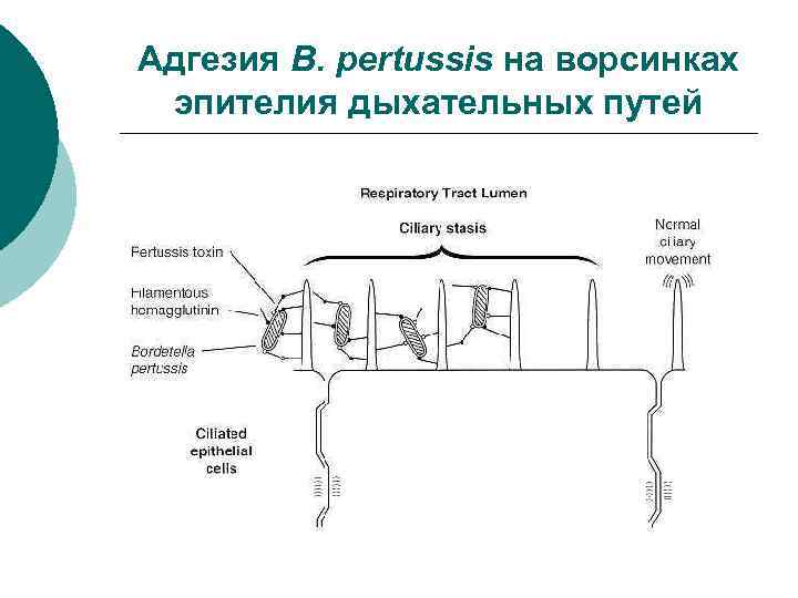 Адгезия B. pertussis на ворсинках эпителия дыхательных путей 