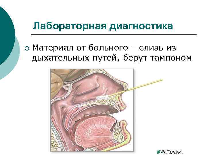 Лабораторная диагностика ¡ Материал от больного – слизь из дыхательных путей, берут тампоном 