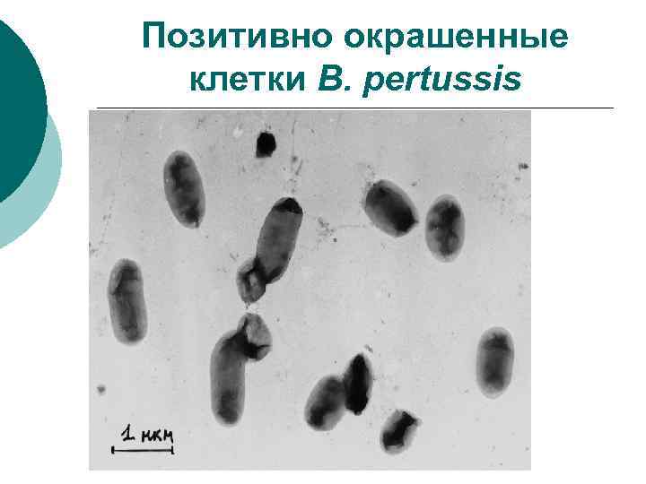 Позитивно окрашенные клетки B. pertussis 