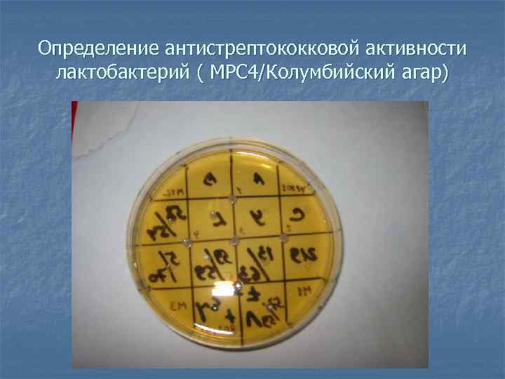 Определение антистрептококковой активноcти лактобактерий ( МРС 4/Колумбийский агар) 